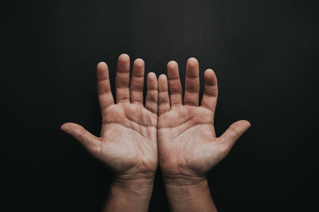 A pair of upturned hands displayed against a dark background, showcasing skin texture, an image for Does God Answer Prayer? Why You Cannot Demonstrate It